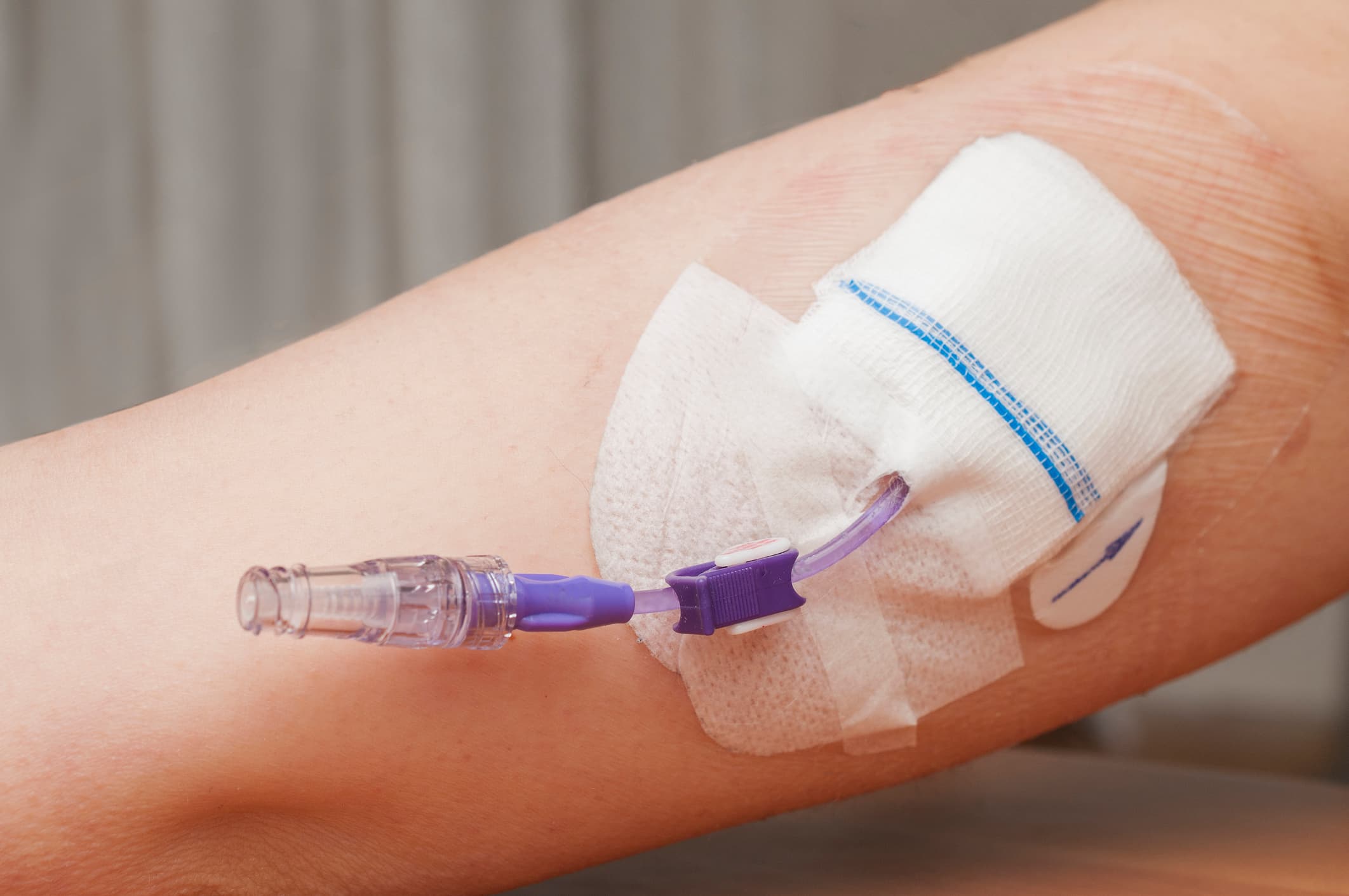Cathéter PICC line en place sur un bras